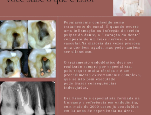 Endodôntia, você sabe o que é isso?